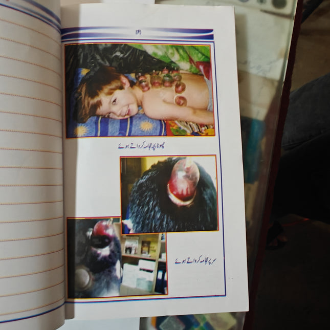 Kitab ul hajama کتاب الحجامہ